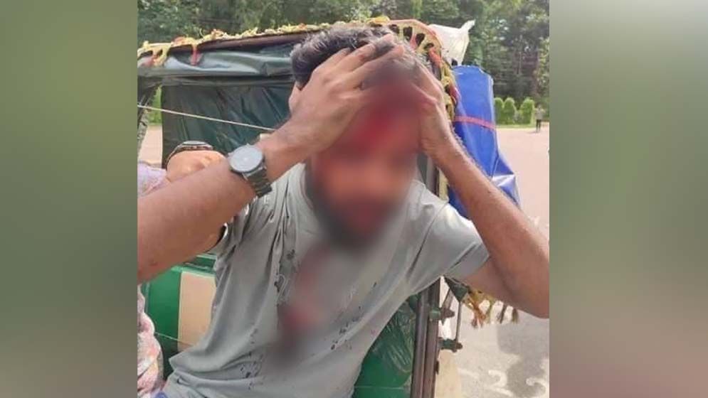 ছবিতে কোটা সংস্কার আন্দোলনকারীদের ওপর হামলা