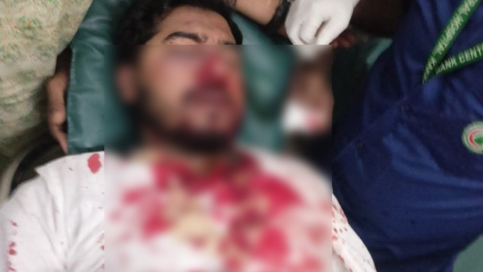 গণঅধিকার পরিষদের বিক্ষোভে হামলায় রক্তাক্ত নুরুল হক