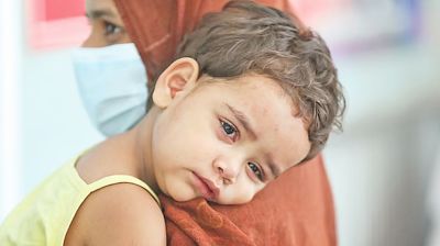 ২৪ ঘণ্টায় হামে আরও ৩ মৃত্যু, আক্রান্ত ৯৪৭